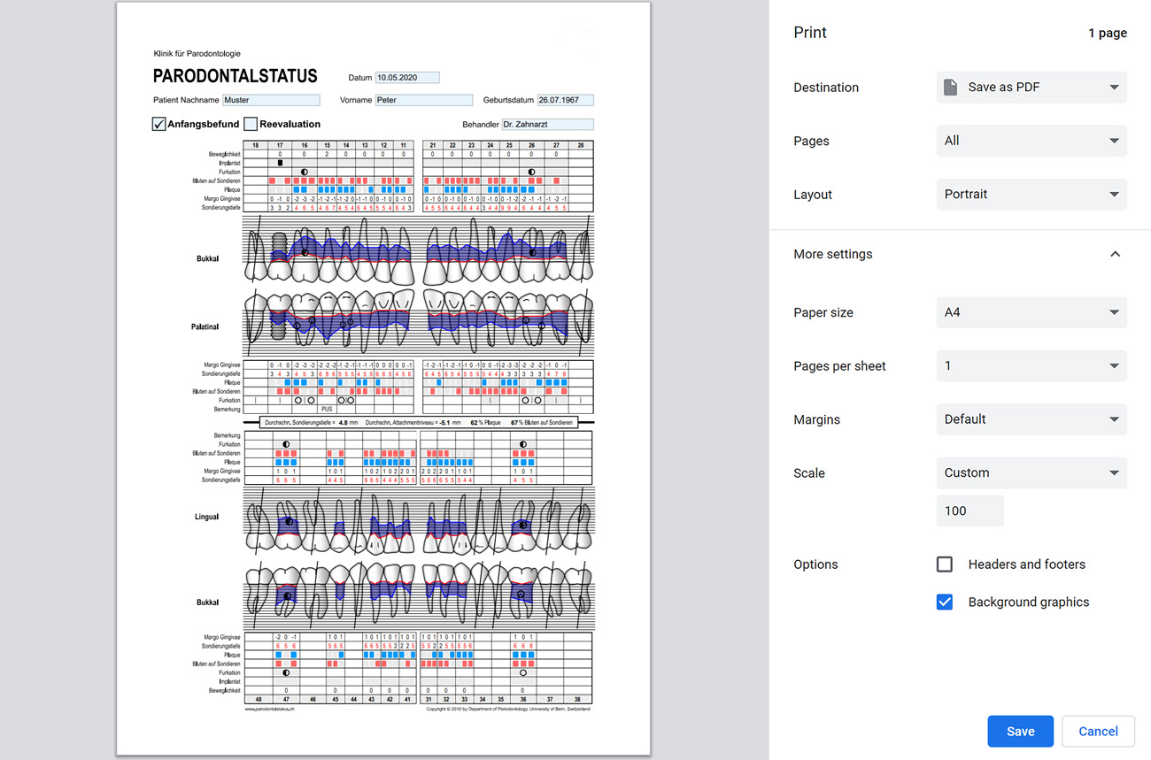 Online periodontal charting tool print preview